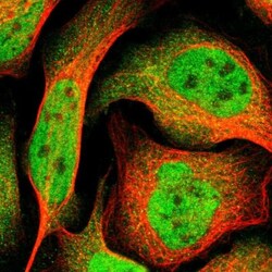 Rad17 Antibody, Novus Biologicals 0.1mL; Unlabeled:Antibodies, Polyclonal